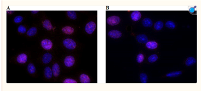 Residual γH2AX fluorescence images obtained for cells incubated A) with Nanopartz in vivo Gold Nanoparticles (D11-50-VM-DIH-50-1) and B) without AuNP. Representative residual γH2AX fluorescence images are shown for cells incubated with AuNP (Figure A) and without AuNP (Figure B). The number of cells with no foci is evidently smaller for the cells incubated with AuNP, indicating increased unrepaired radiation damage.